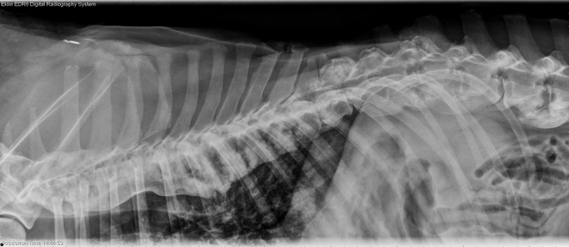 R LAT Spine