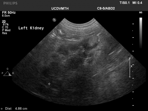 Ultrasound L Kidney