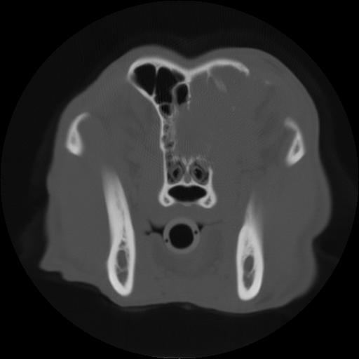 CT Skull