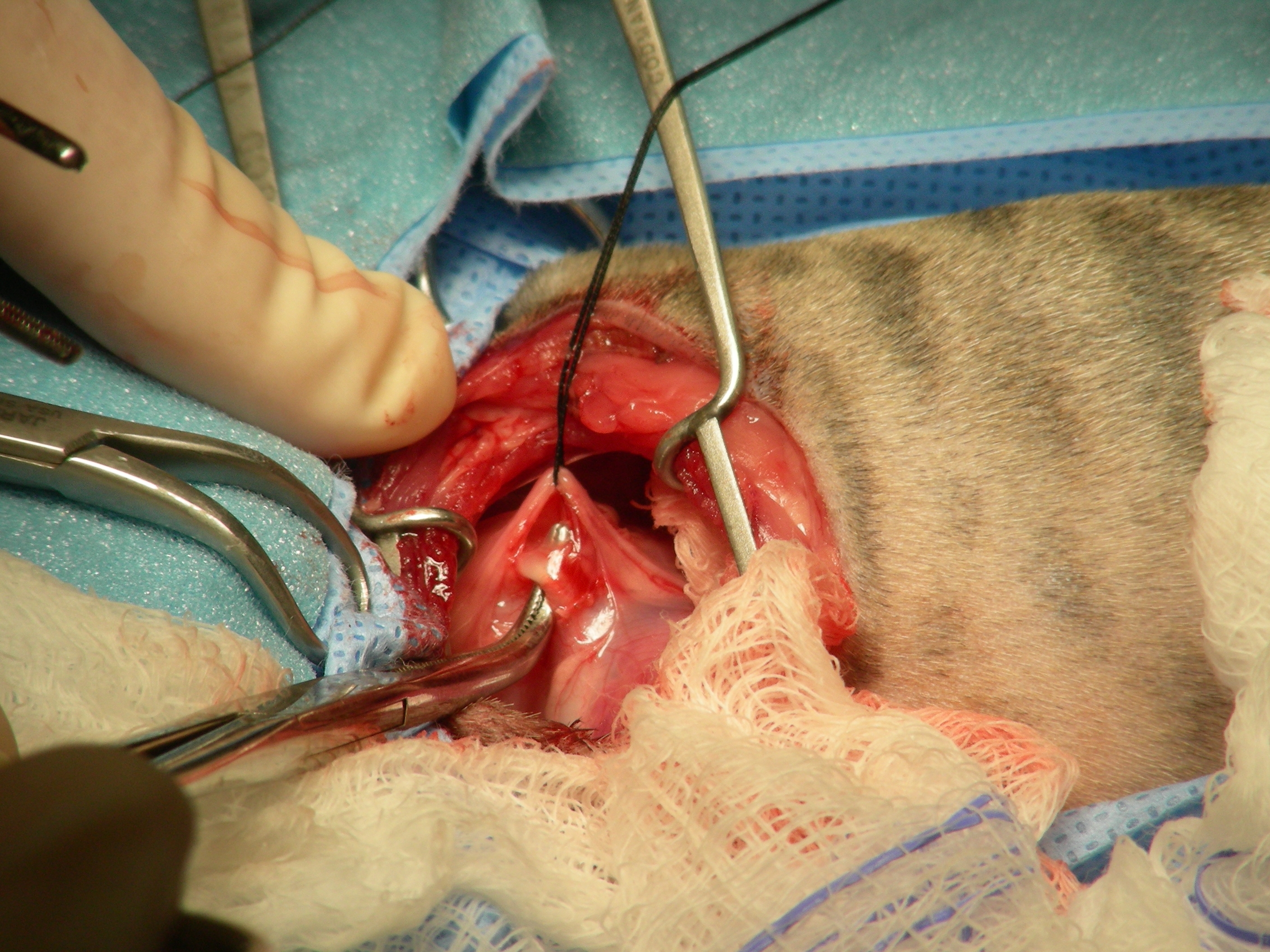 Surgery