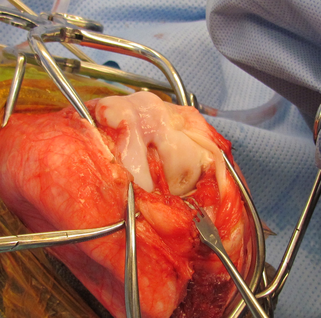 cod170928-left_stifle_surgery