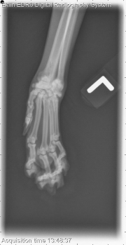 Thoracic Limb-L AP Fore