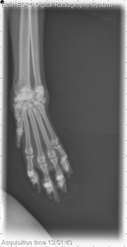 Thoracic Limb-L AP Fore