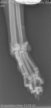 Thoracic Limb-L LAT Fore