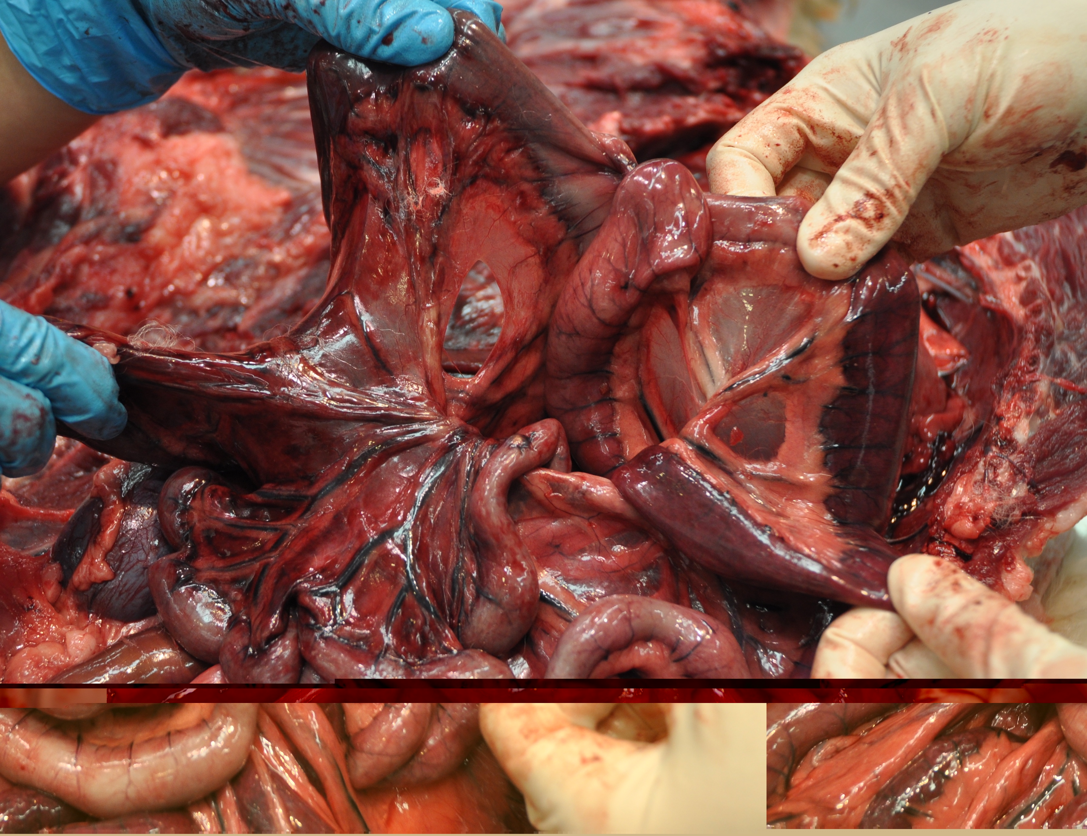 cod190214-path_intestinal_rent