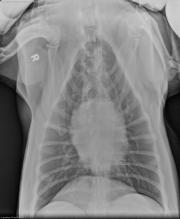 VD Thorax