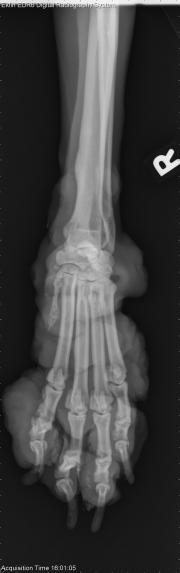 Thoracic Limb-R AP Fore