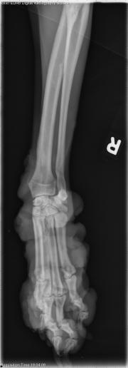 Thoracic Limb-R LAT Fore