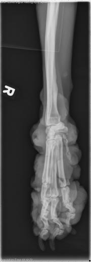 Thoracic Limb-R LAT Fore