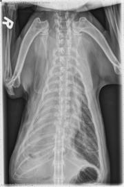 VD Thorax