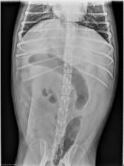 VD Abdomen