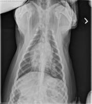 DV LAT Thorax