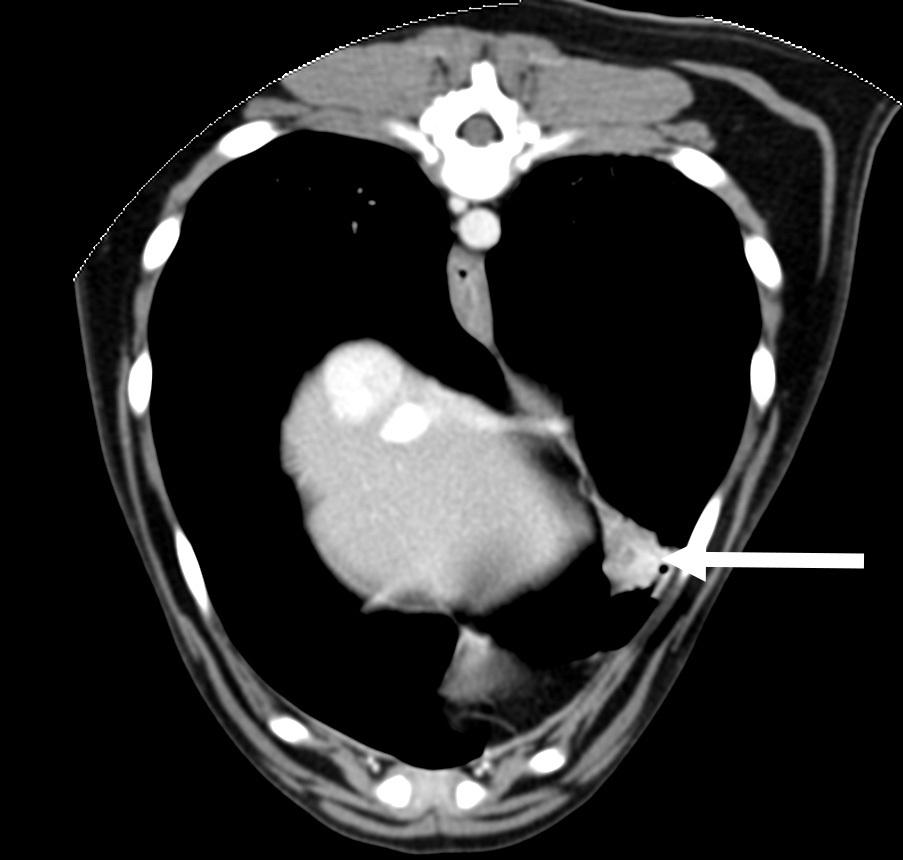 CT-gastric_foreign_body_CONTRAST