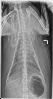 DV Thorax
