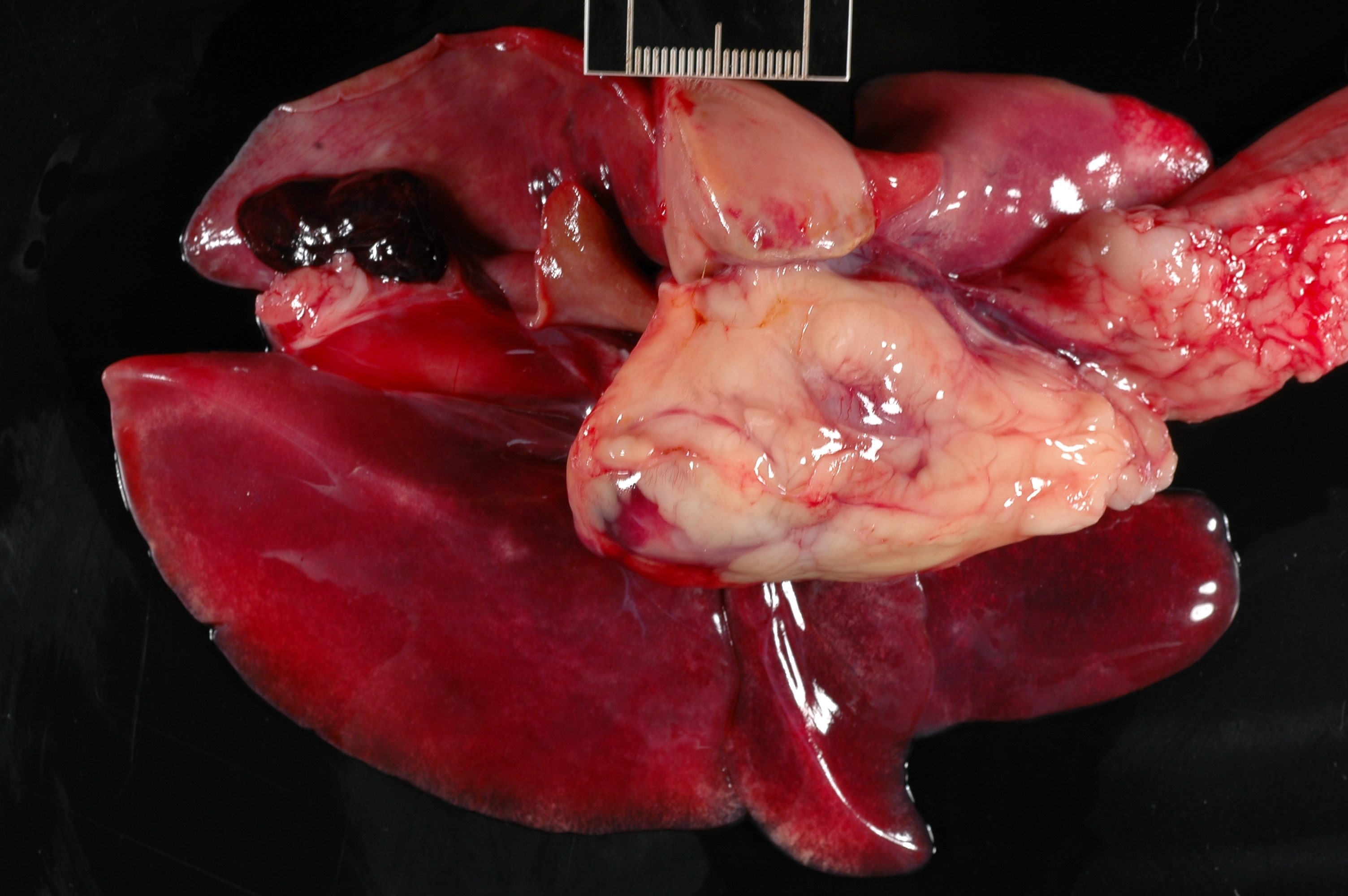 Lung Pathology