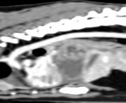 CT Sagittal