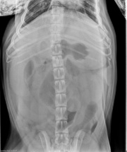 VD Abdomen